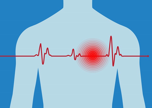 植込み型心電計（ICM）とは